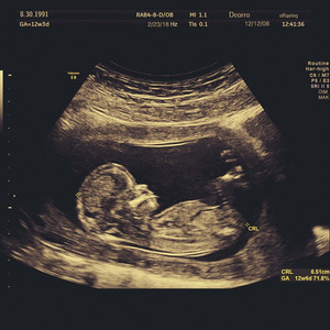 免费➕无码➕国产在线观看按摩
